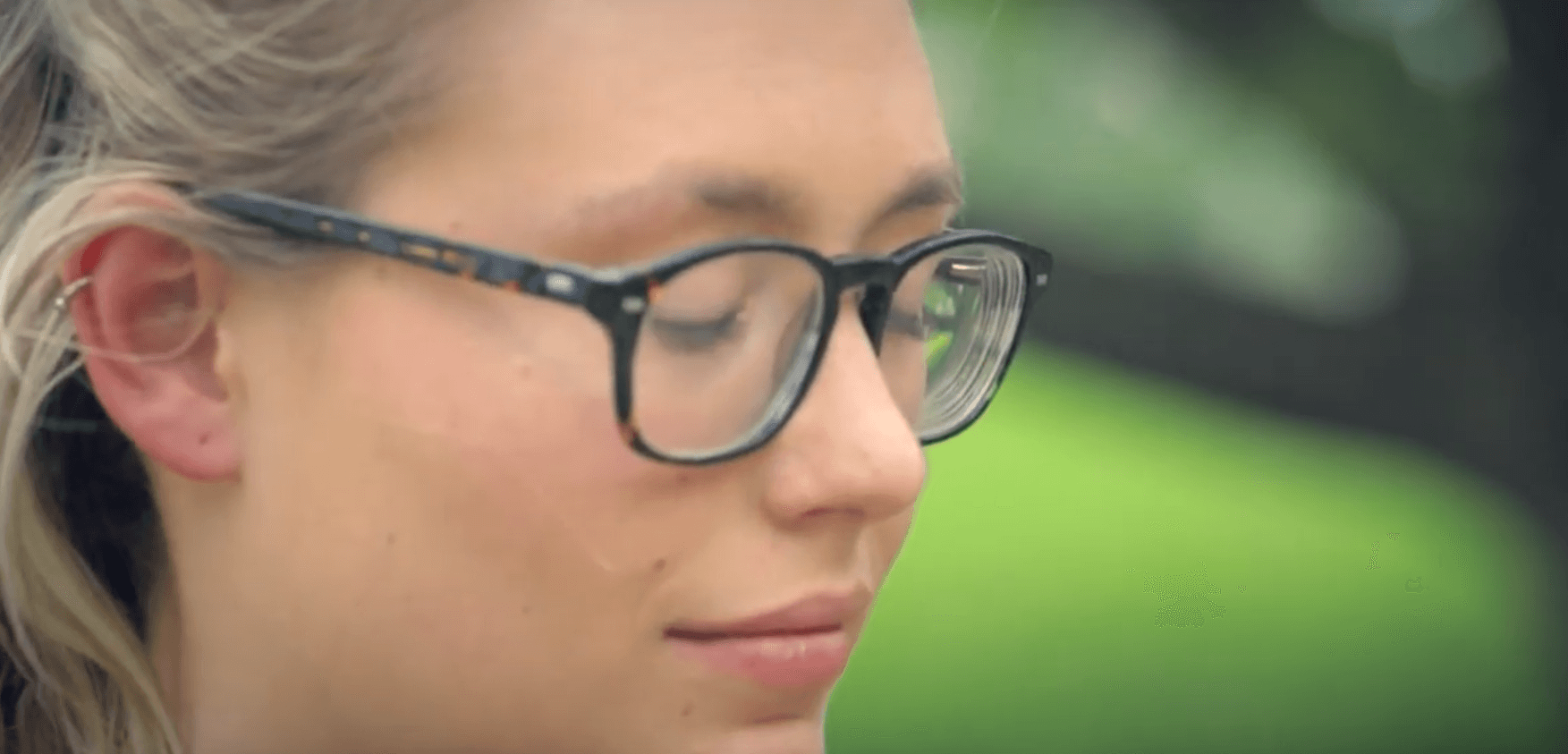 Jessica before LASIK surgery