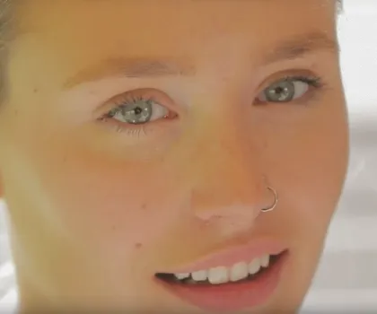 Jessica after LASIK Surgery